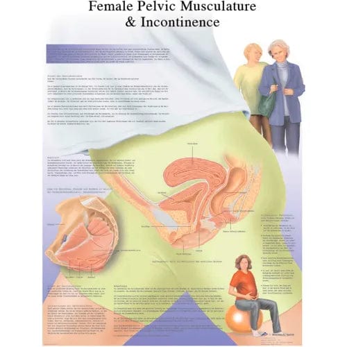 Centerline Dynamics Anatomical Models & Charts Anatomical Chart - Female Urinary Incontinence Chart, Laminated