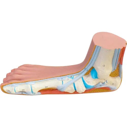 Centerline Dynamics Anatomical Models & Charts Anatomical Model - Flat Foot (Pes Panus)