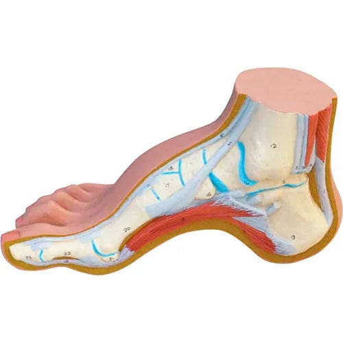 Centerline Dynamics Anatomical Models & Charts Anatomical Model - Hollow Foot (Pes Cavus)