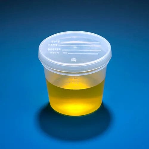 Centerline Dynamics Specimen Bags & Containers Graduated Specimen Container, 5 oz.. Snap Cap, Polypropylene, 300/Pack