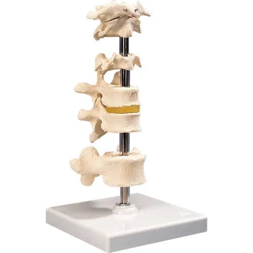 Centerline Dynamics Anatomical Models & Charts Anatomical Model - 6 Mounted Vertebrae with Removable Stand