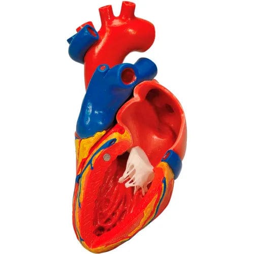 Centerline Dynamics Anatomical Models & Charts Anatomical Model - Heart with Bypass, 2-Part